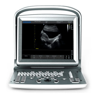 Portable ultrasound system ECO 5 – جهاز سونار محمول